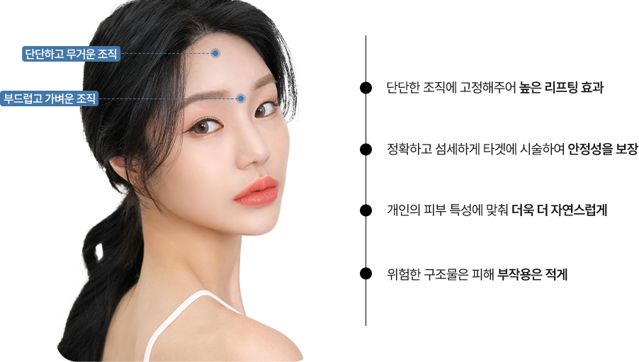 눈썹거상리프팅