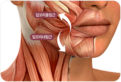 입꼬리성형