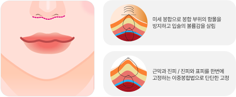인중축소