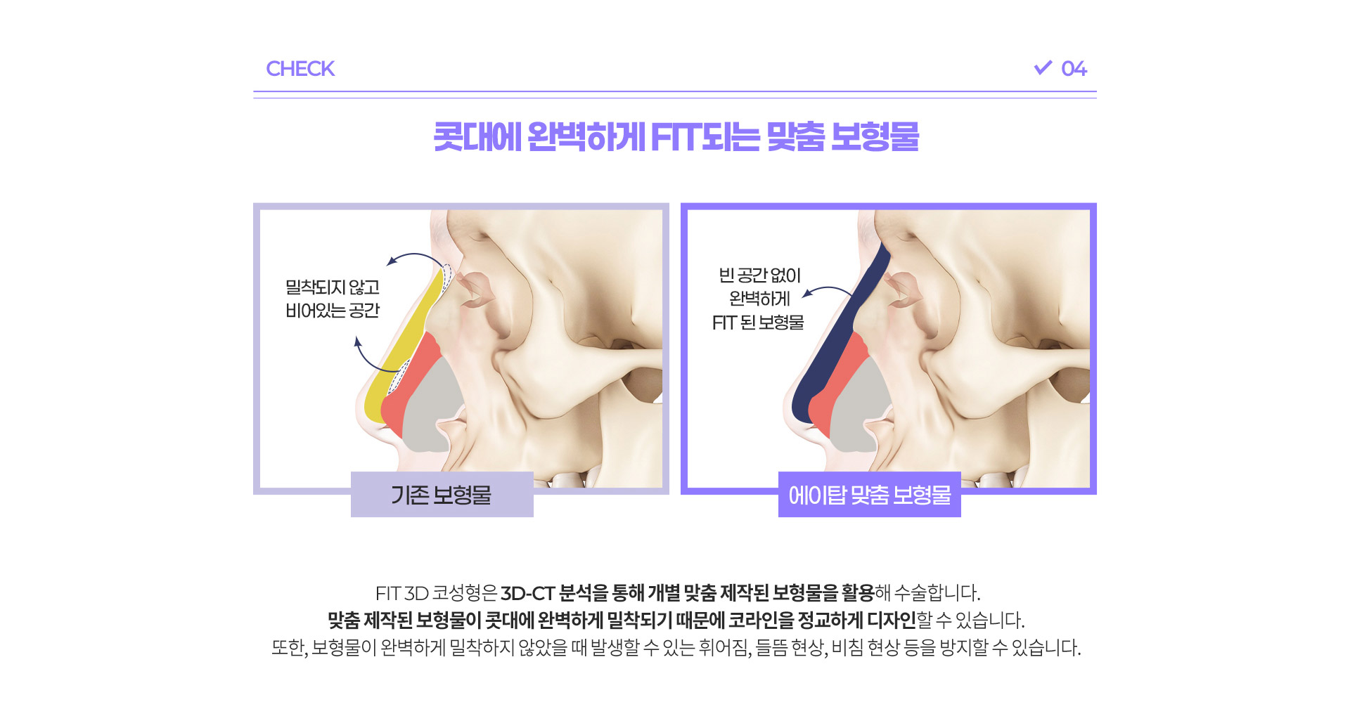 남자기능코성형