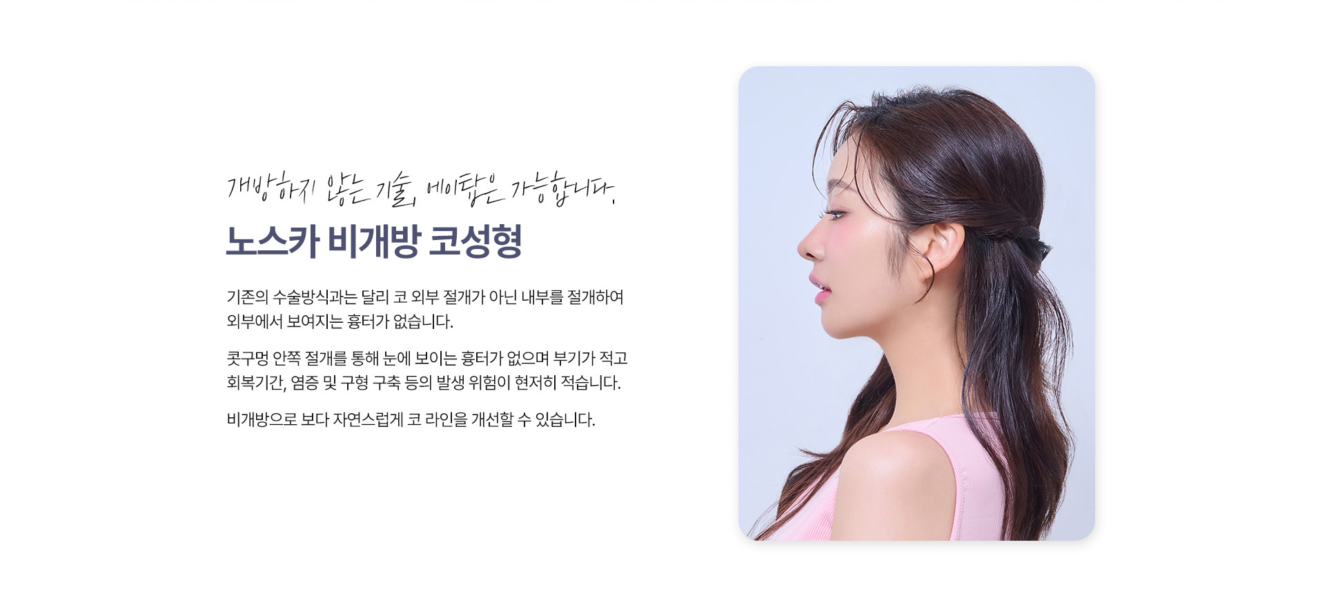 노스카 비개방 코성형