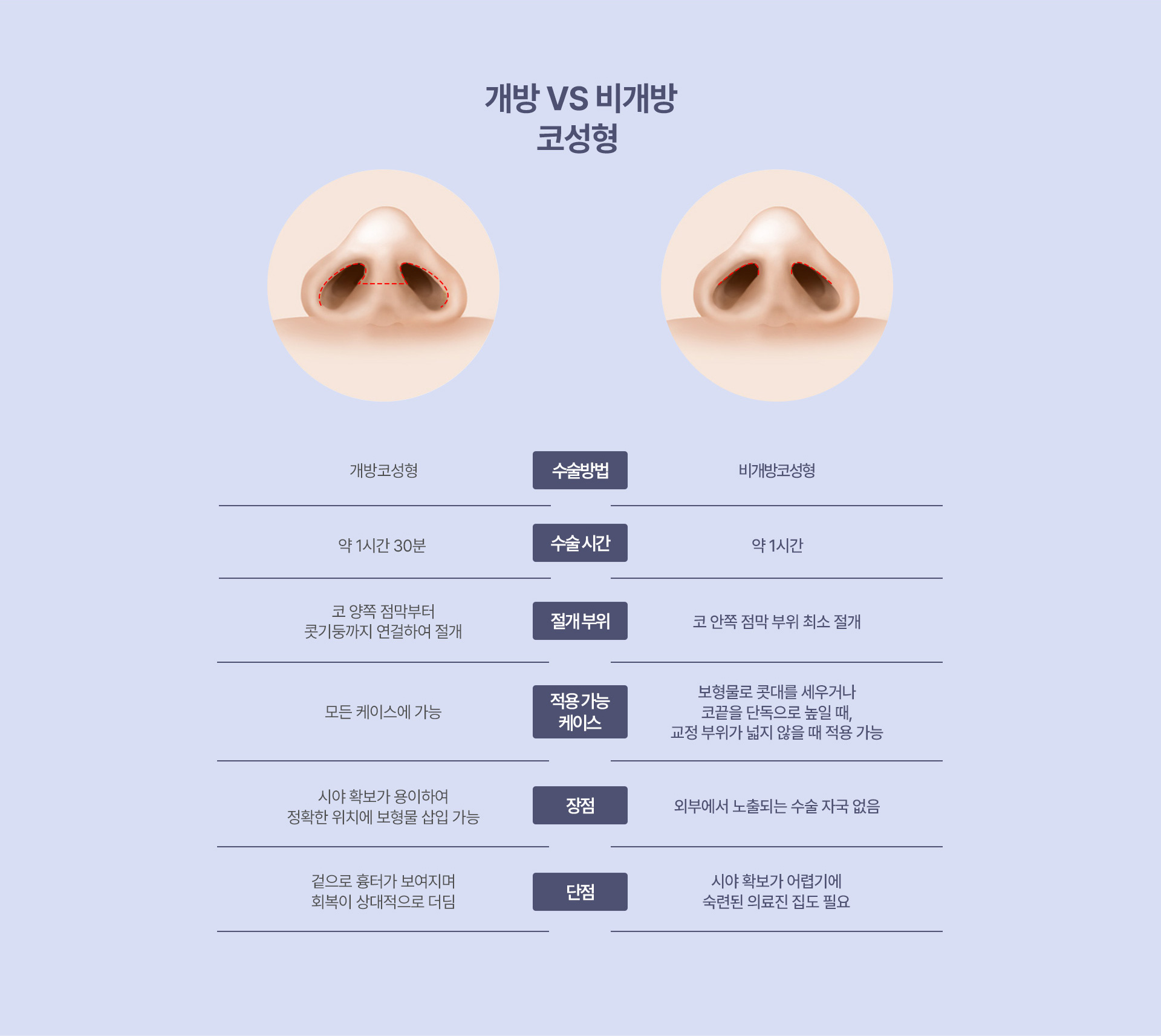 노스카 비개방 코성형