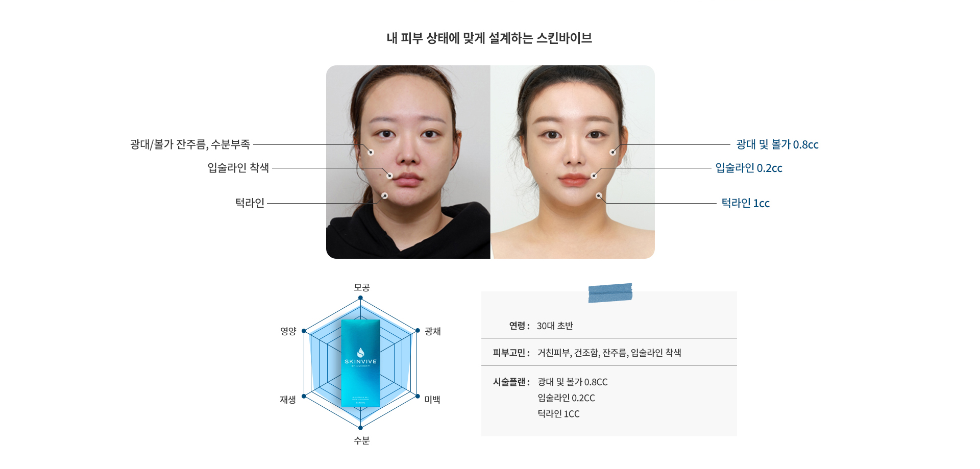 스킨바이브