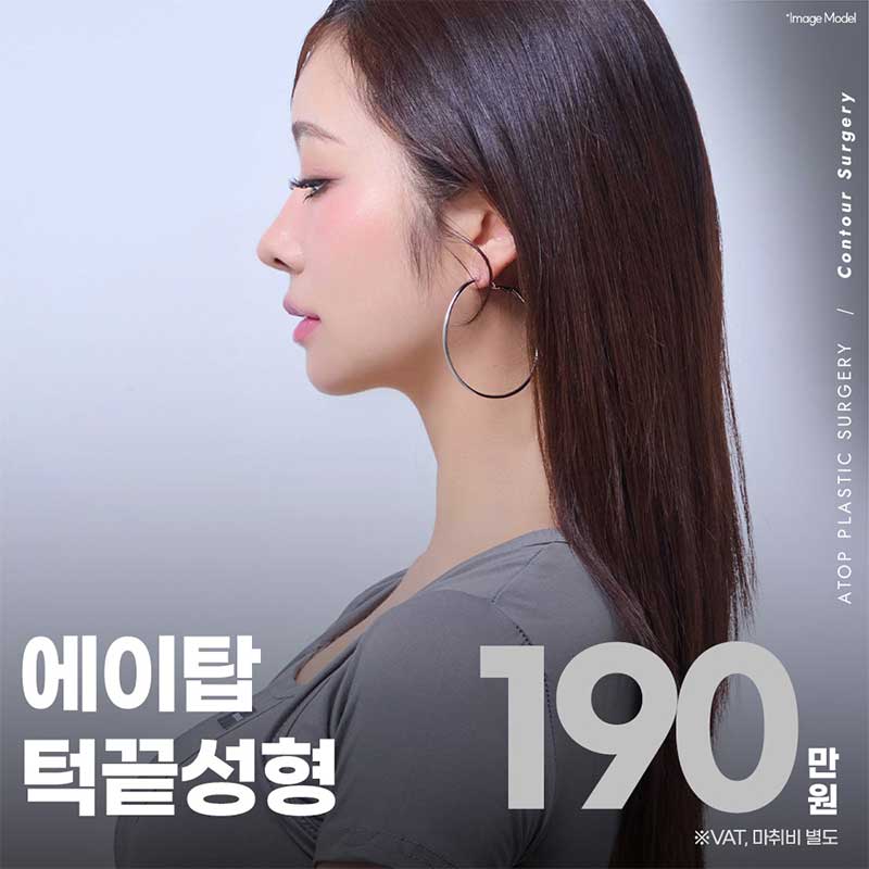 V라인 턱끝성형
