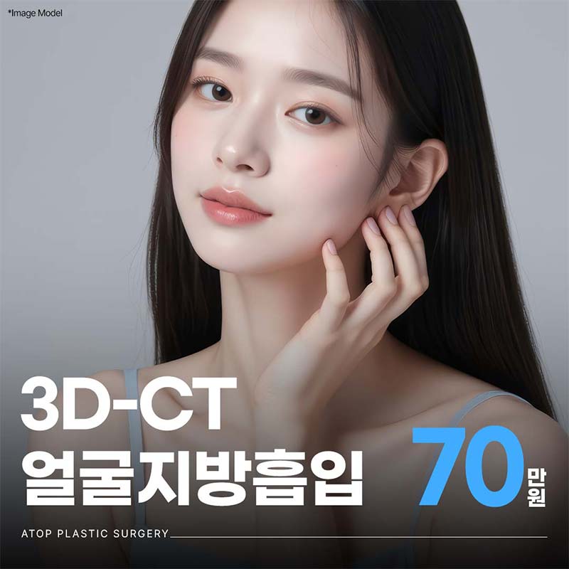 3D-CT 얼굴 지방 흡입