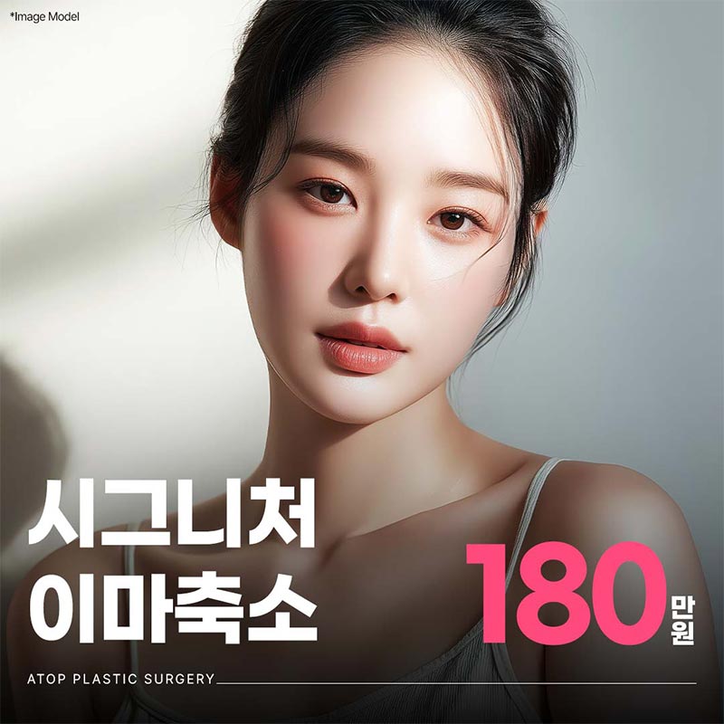 이마축소술