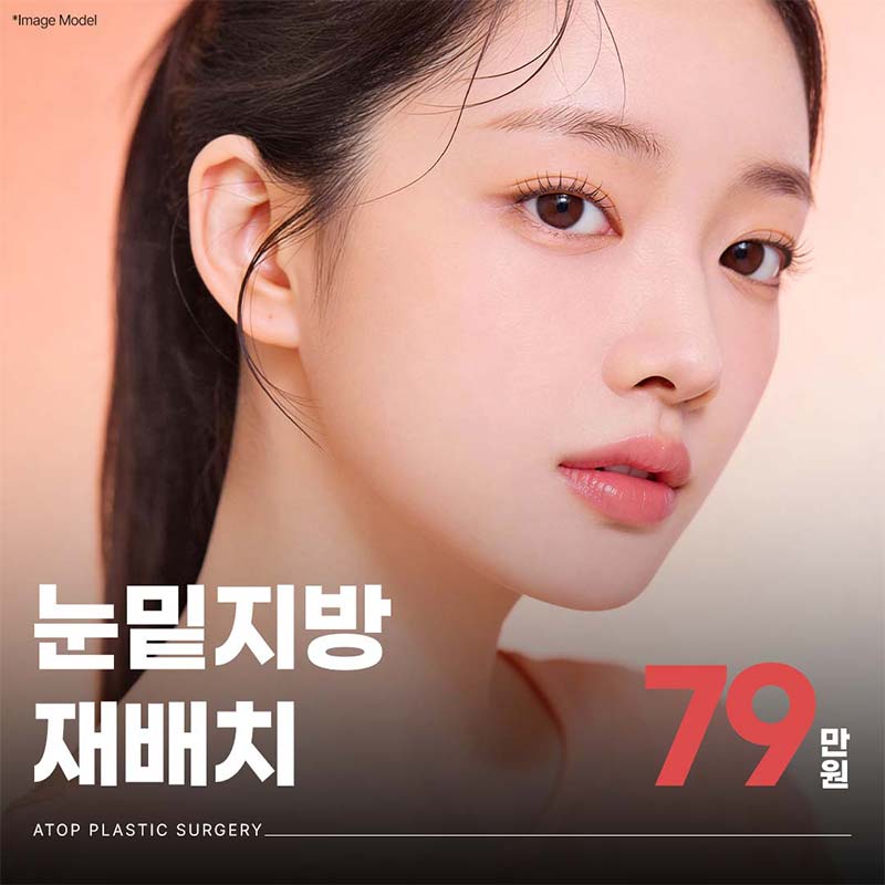 눈밑지방재배치&제거