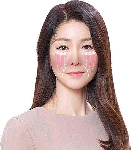 에이탑성형외과 중안면부 리프팅 이미지
