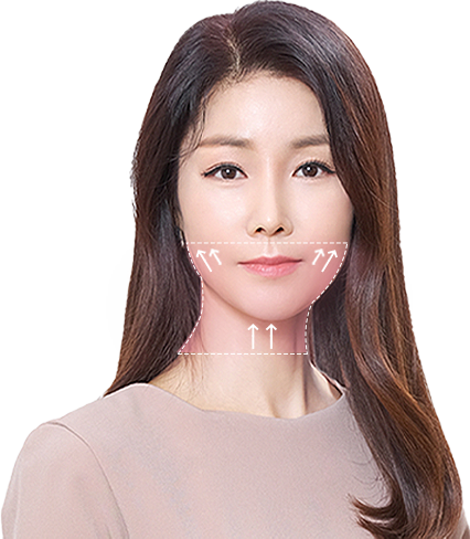 에이탑성형외과 하안면부 리프팅 이미지