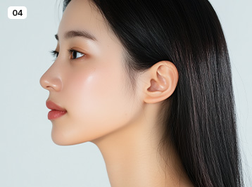 에이탑성형외과 3D 코성형 수술방법