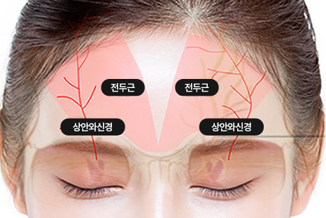 에이탑성형외과 내시경 이마거상 신경보존리프팅 기술력 이미지