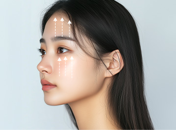 에이탑성형외과 실리프팅 이마, 앞광대 수술 이미지