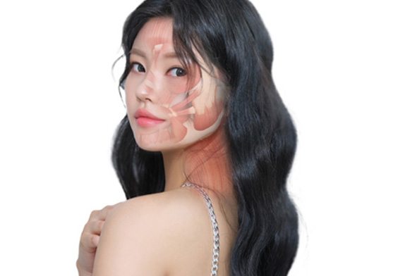 에이탑성형외과 에이탑 보톡스 기술력 자연스러움