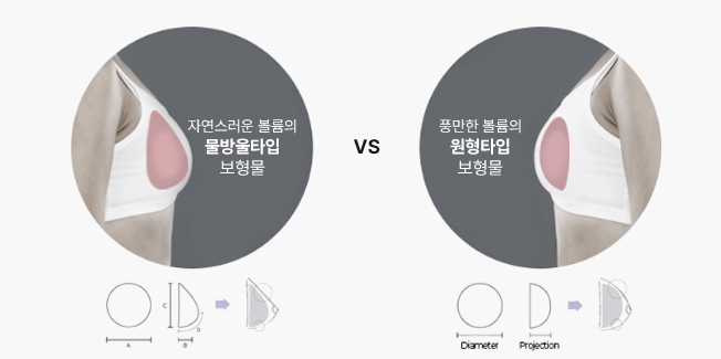 에이탑성형외과 가슴축소거상 보형물 선택에 대한 충분한 상담