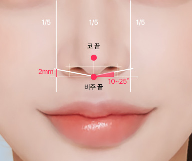 에이탑성형외과 비주성형 비주의 각도