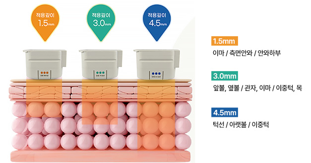 에이탑성형외과 울쎄라피프라임 3가지 트랜스듀서