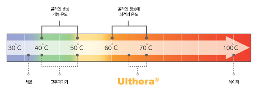 에이탑성형외과 울쎄라피프라임 리프팅 최적 온도