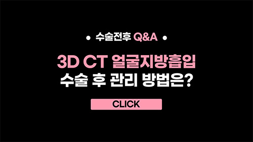 3D CT 얼굴지방흡입 수술 후 관리 방법은?